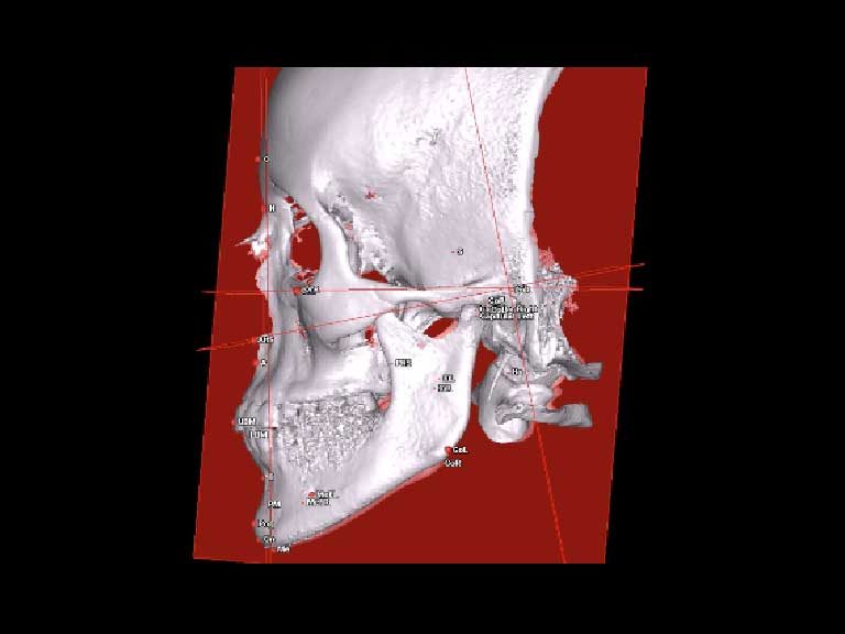 ibbro-tomografia-04